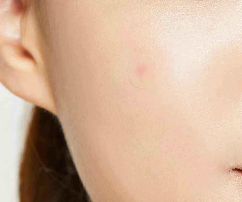COSRX Acne Pimple Master Patch2_kimmi.png